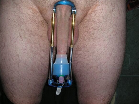 阴茎增大延长器
